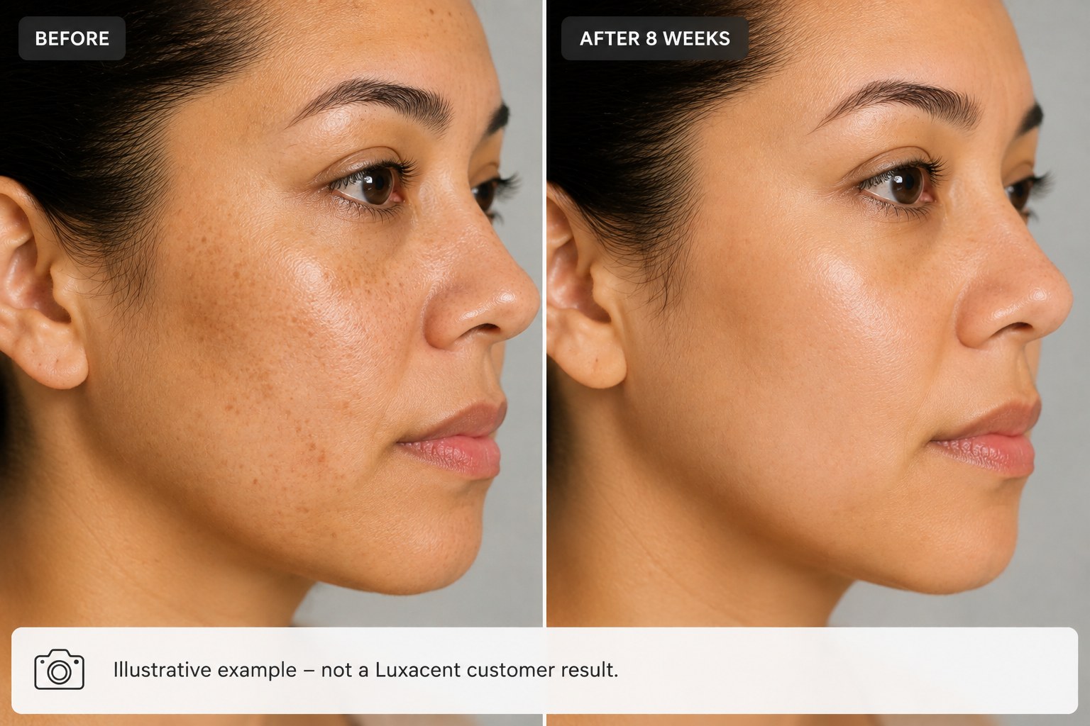 Illustrative before and after example after 8 weeks — not a Luxacent customer result