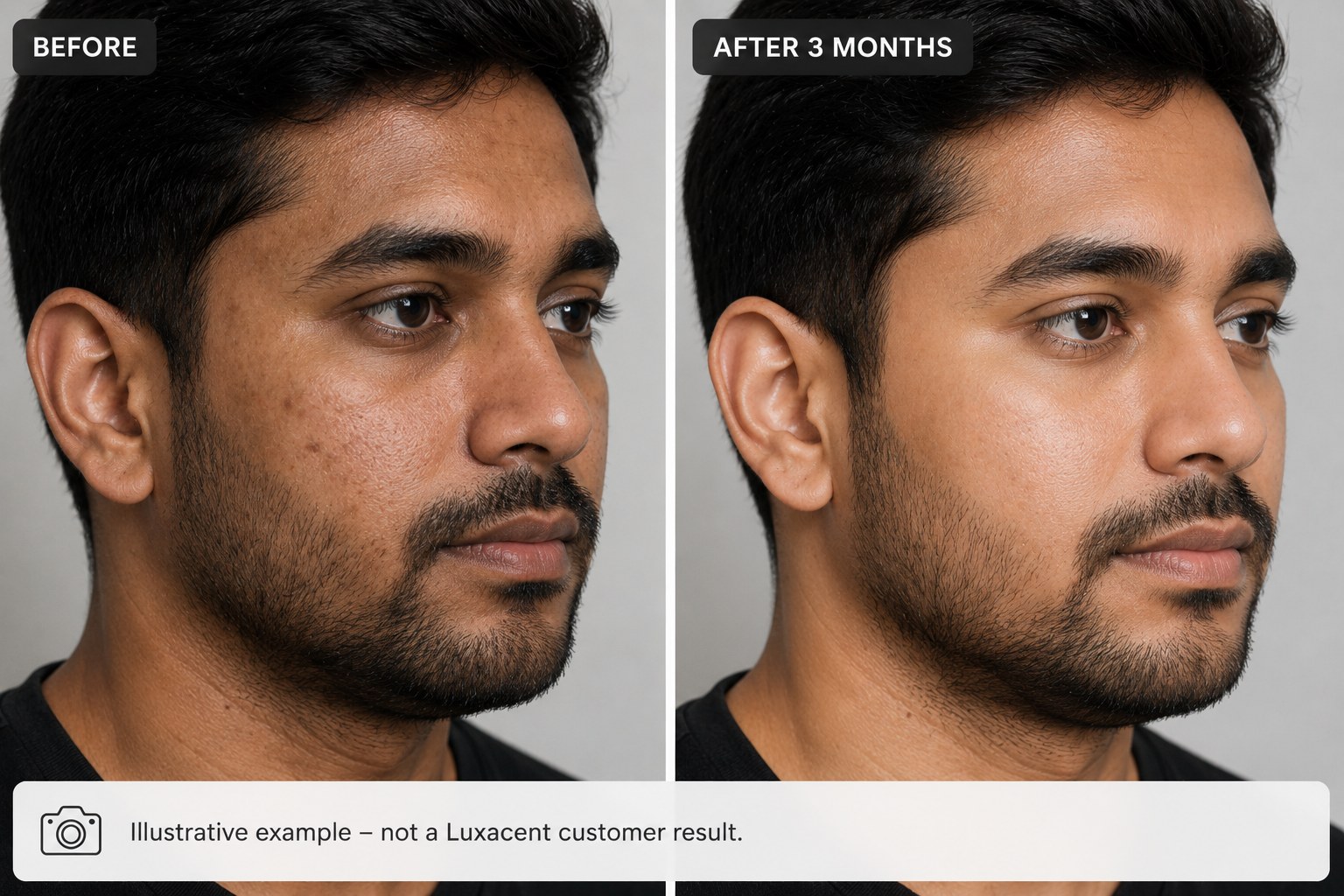 Illustrative before and after example after 3 months — not a Luxacent customer result